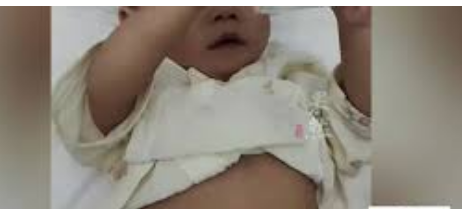 女子备孕10年生下宝宝患尿毒症